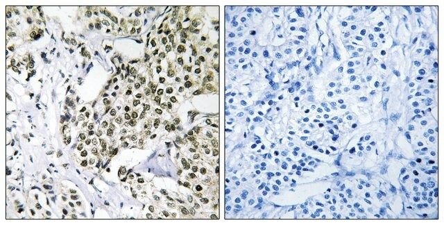 Anti-CAGE1 antibody produced in rabbit