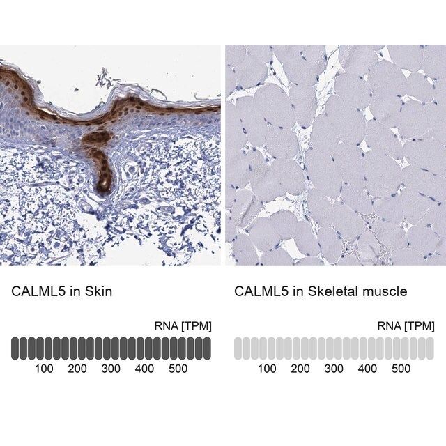 Anti-CALML5 antibody produced in rabbit