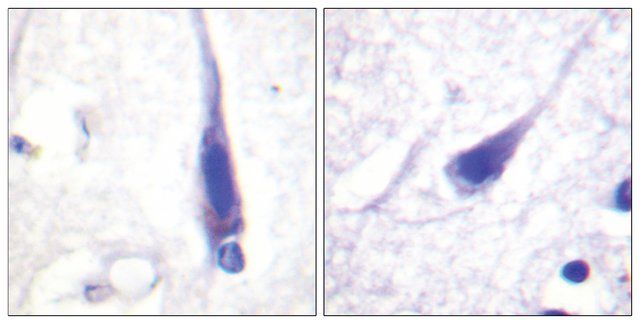 Anti-Calmodulin antibody produced in rabbit