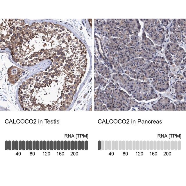 Anti-CALCOCO2 antibody produced in rabbit