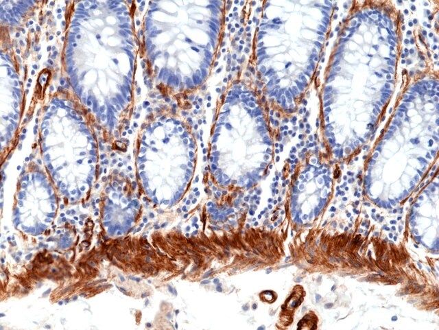 Anti--CALD1 (Caldesmon) Rabbit Monoclonal Antibody