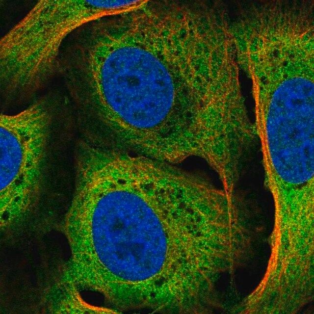 Anti-CACYBP antibody produced in rabbit
