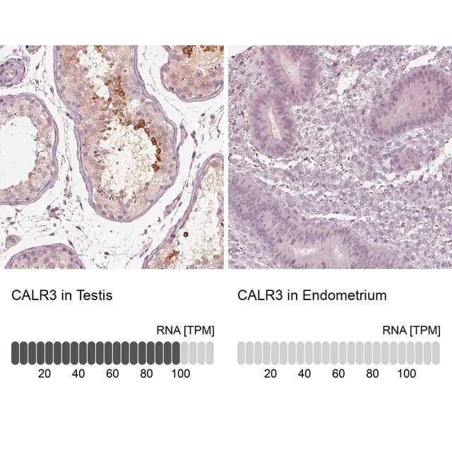 Anti-CALR3 antibody produced in rabbit