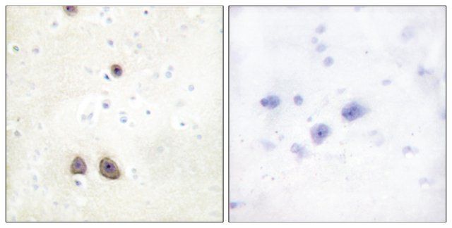 Anti-Caper antibody produced in rabbit