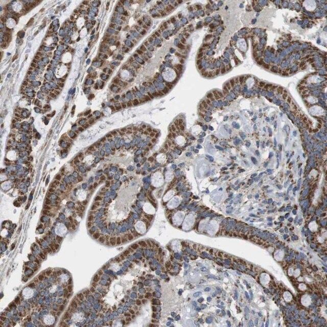 Anti-CALHM2 antibody produced in rabbit