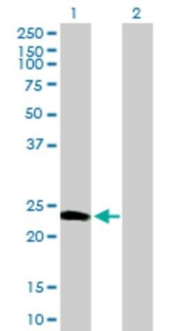 Anti-CALN1 antibody produced in mouse