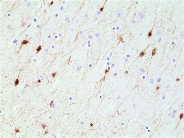 Anti-Calretinin (CALB2) antibody, Rabbit monoclonal