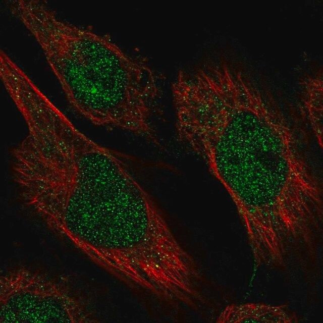 Anti-CAMTA2 antibody produced in rabbit