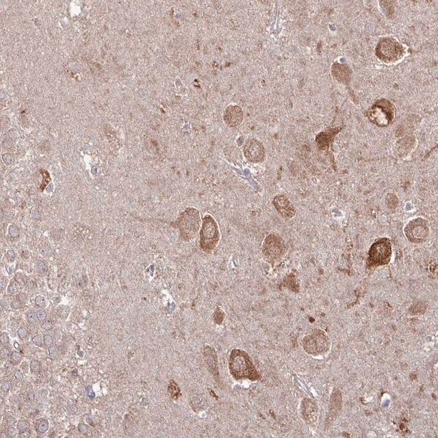 Anti-CAMK2A antibody produced in rabbit