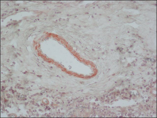 Anti-Calponin antibody, Mouse monoclonal