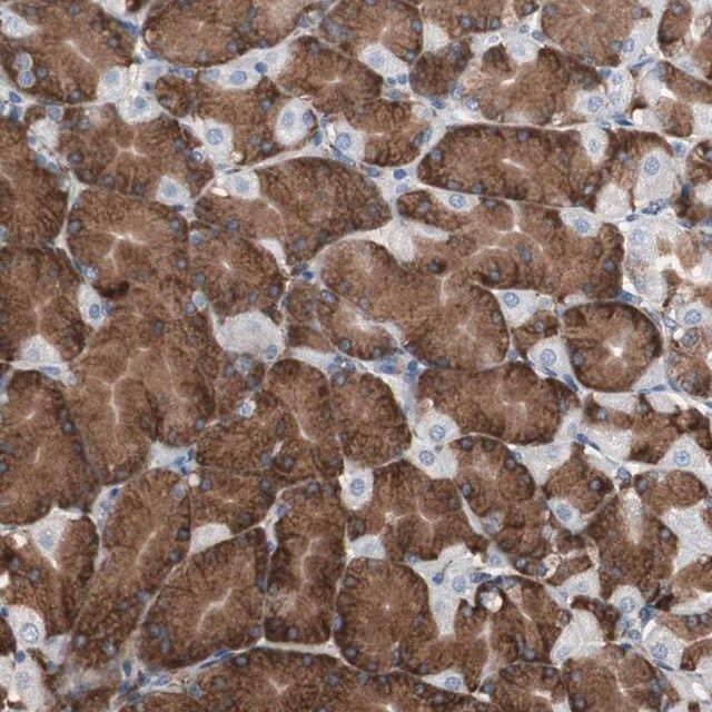 Anti-CALU antibody produced in rabbit