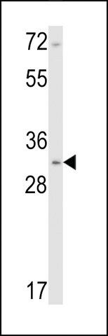 ANTI-CALPONIN-1(N-TERMINAL) antibody produced in rabbit