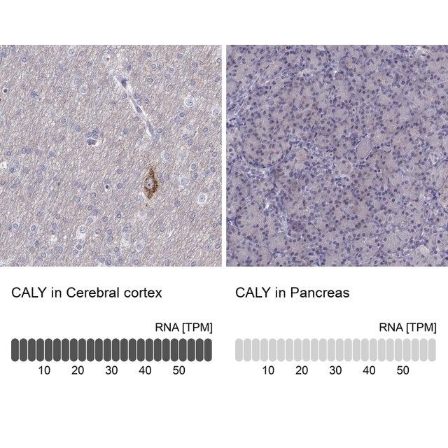 Anti-CALY antibody produced in rabbit