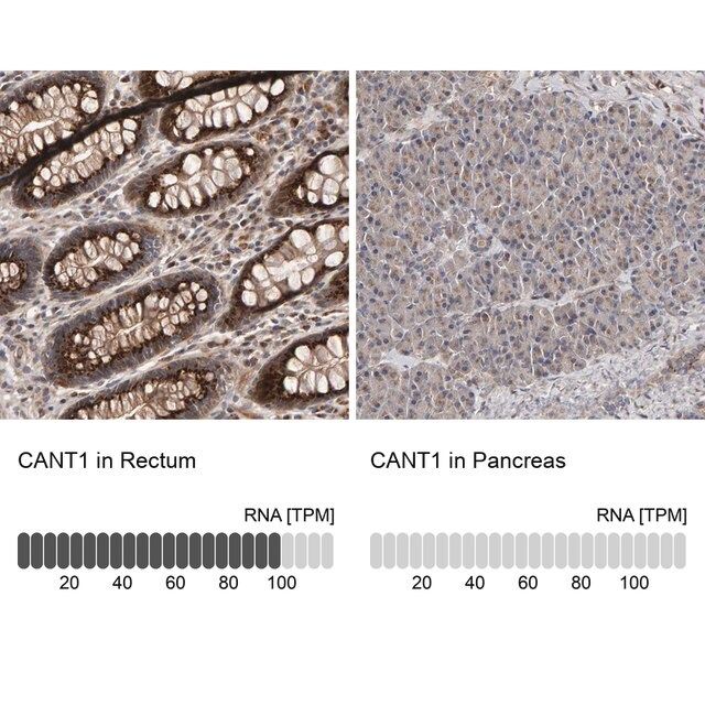 Anti-CANT1 antibody produced in rabbit
