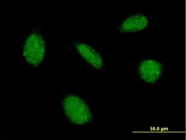 Anti-CAMK4 antibody produced in mouse