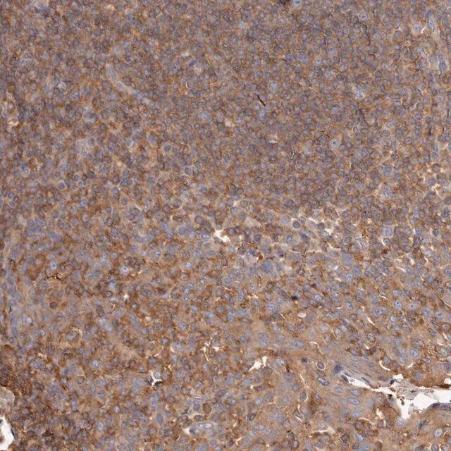 Anti-CAP1 antibody produced in rabbit