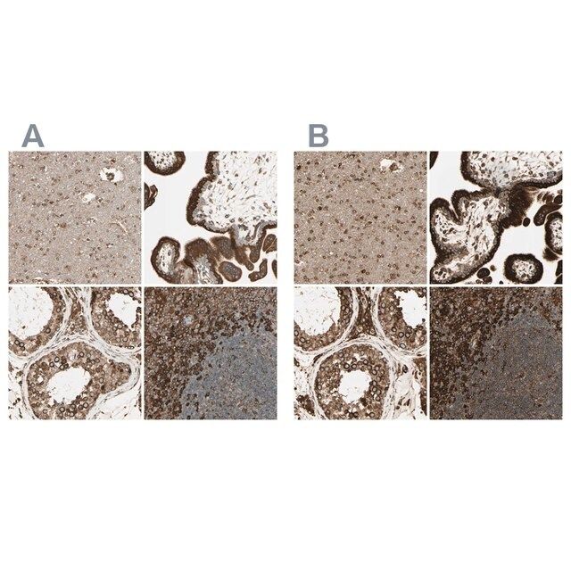 Anti-CANX antibody produced in rabbit