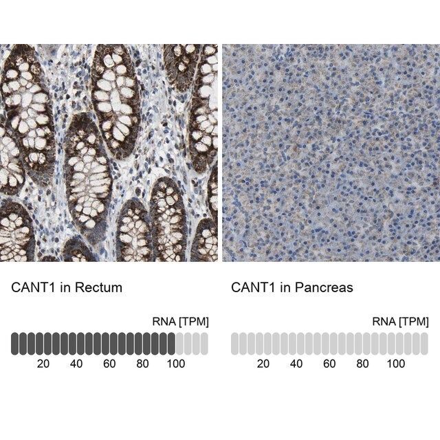 Anti-CANT1 antibody produced in rabbit