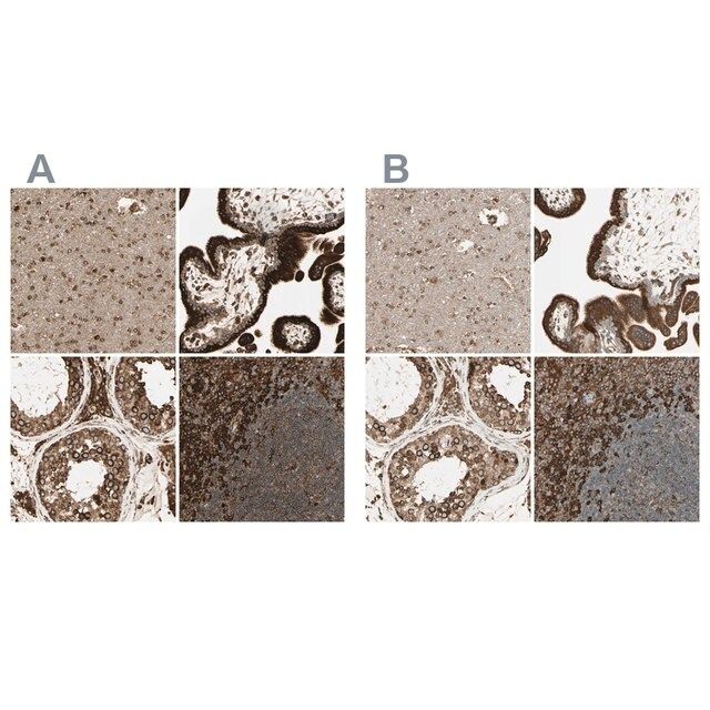Anti-CANX antibody produced in rabbit