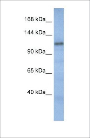Anti-CAND2 antibody produced in rabbit
