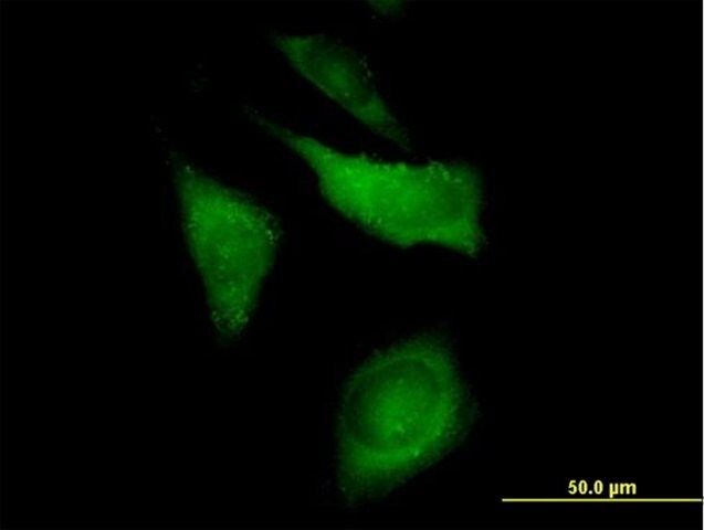 Anti-CAP1 antibody produced in mouse