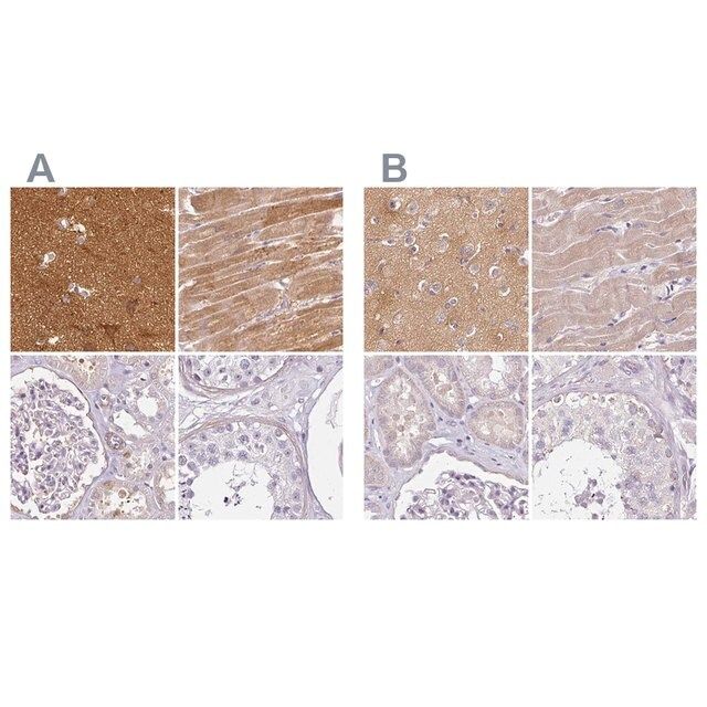 Anti-CAP2 antibody produced in rabbit