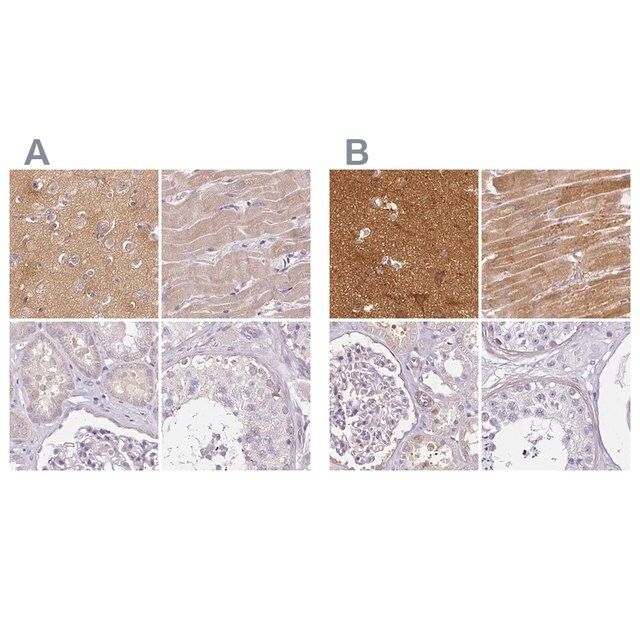 Anti-CAP2 antibody produced in rabbit