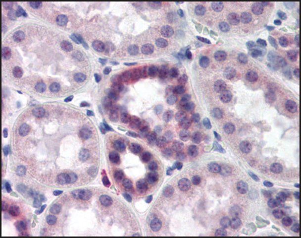 Anti-CAND2 antibody produced in rabbit