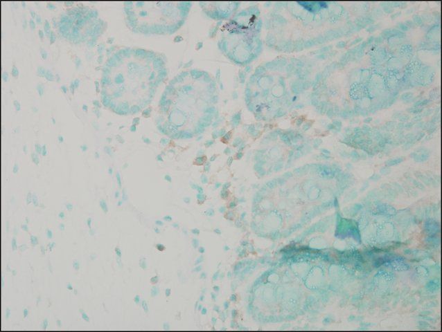 Anti-CANX antibody produced in rabbit