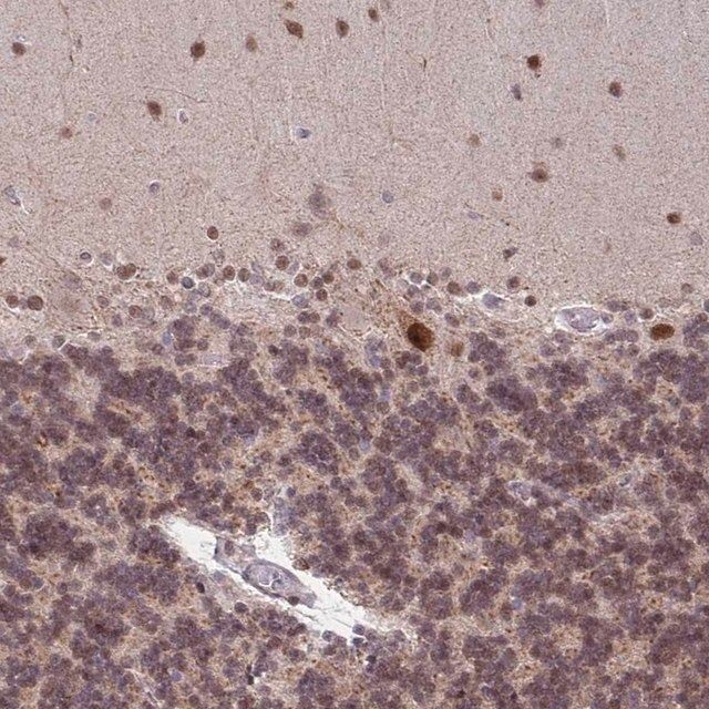 Anti-BRD3 antibody produced in rabbit