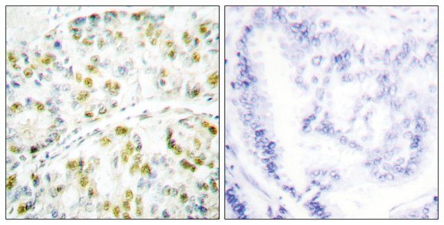 Anti-Ataxin 1, C-Terminal antibody produced in rabbit