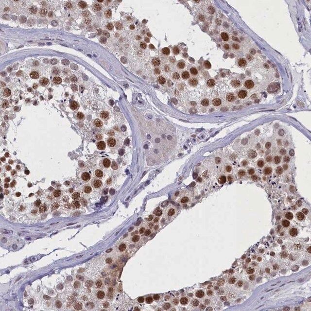 Anti-ATF7IP2 antibody produced in rabbit