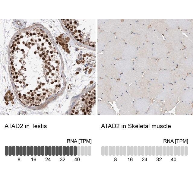 Anti-ATAD2 antibody produced in rabbit