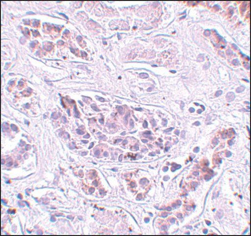Anti-ATG3 antibody produced in rabbit