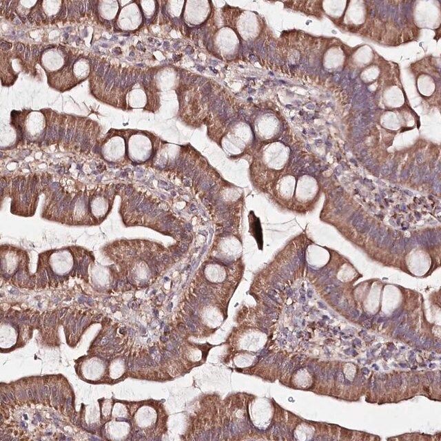 Anti-ATE1 antibody produced in rabbit