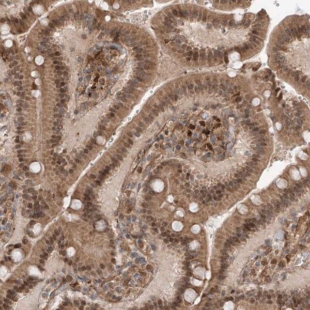 Anti-ATAD2B antibody produced in rabbit