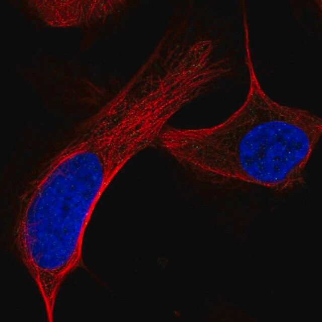 Anti-ATM antibody produced in rabbit