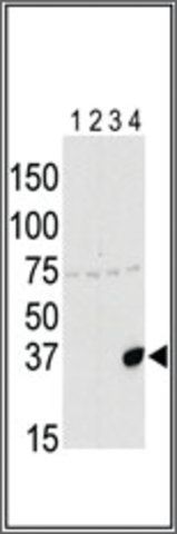 ANTI-AURORA-C (N-TERM G11) antibody produced in rabbit