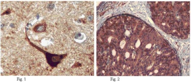 Anti-Autotaxin Antibody