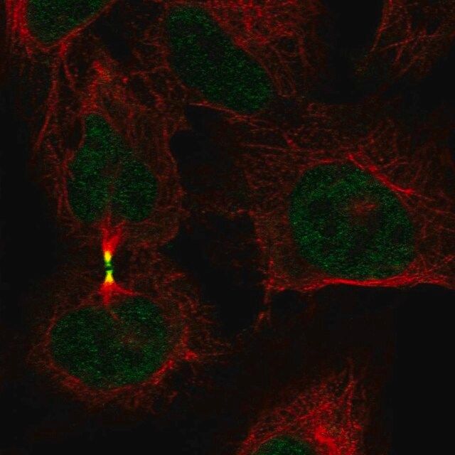 Anti-AURKB antibody produced in rabbit