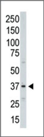 Anti-Aurora-C (C-term) antibody produced in rabbit