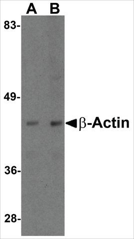 Anti-β-Actin antibody produced in chicken
