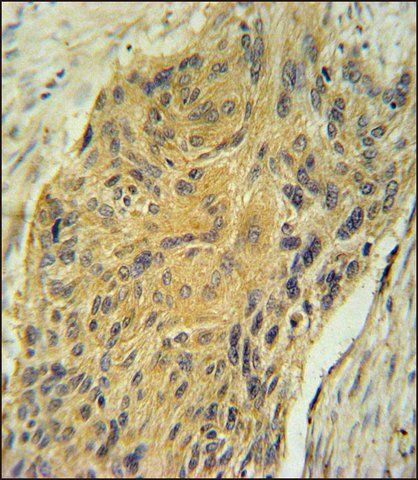 ANTI-AVP (CENTER) antibody produced in rabbit