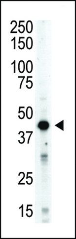 ANTI-AURORA-B (ARK/STK12) (CENTER) antibody produced in rabbit