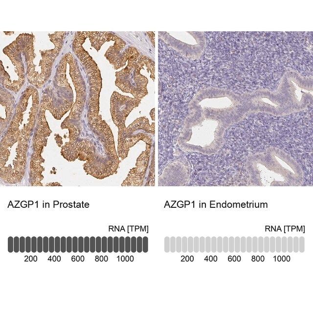 Anti-AZGP1 antibody produced in rabbit