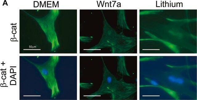 Anti-β-Catenin Antibody, clone 5H10