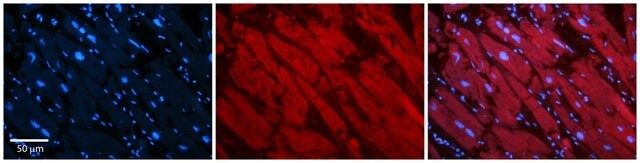 Anti-ASPH, (N-terminal) antibody produced in rabbit