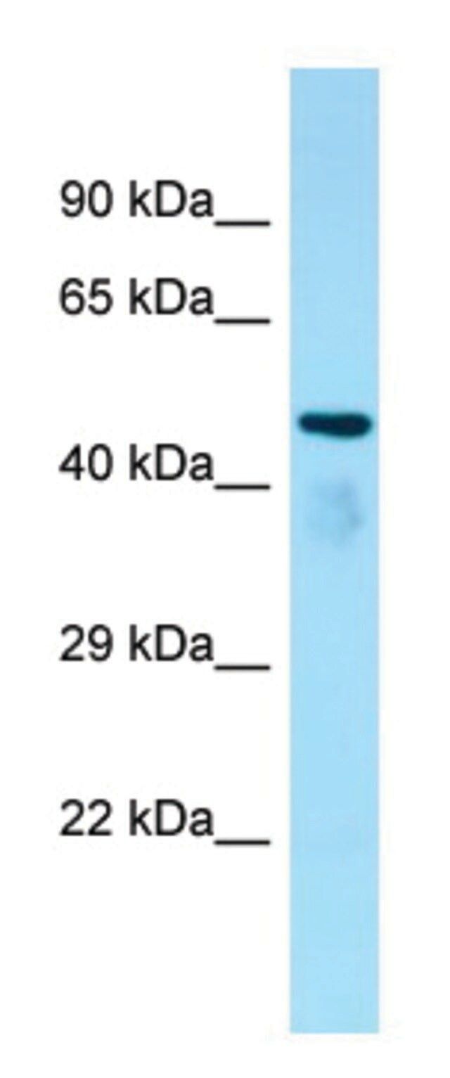 Anti-ATAT1 antibody produced in rabbit