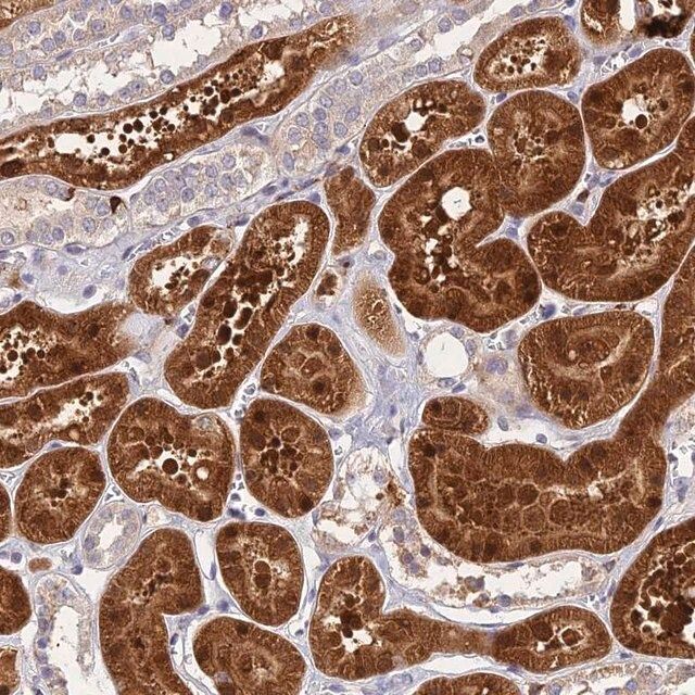 Anti-ASPDH antibody produced in rabbit