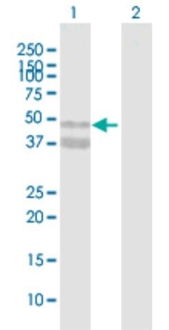 Anti-ASPN antibody produced in mouse